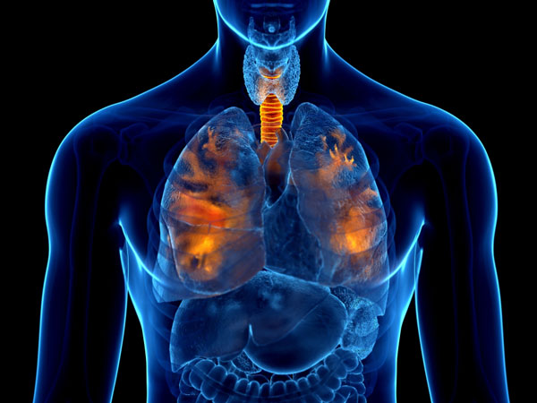 폐렴 환자 5년 새 115% 증가, 기저질환자 사망률 더 높아