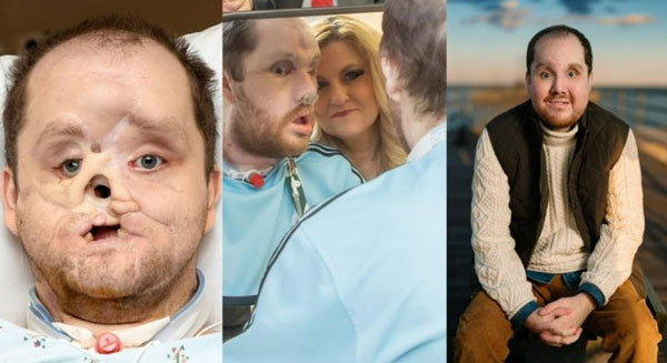 �ȸ� �̽� ���