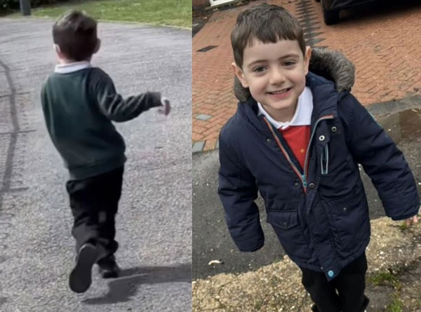 4살 아이의 우스꽝스러운 걸음걸이, 척추 파괴하는 '이 병' 때문이었다