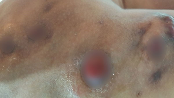 ������ũ ó���� ���� ����