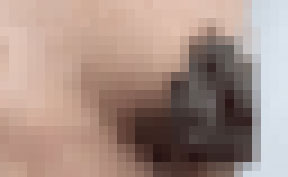 “유두 까맣게 변해”… 30대 女, 대체 무슨 일?