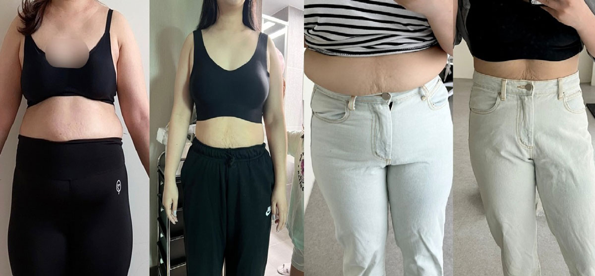 ���� ���� �̹���