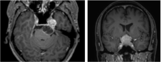 �ΰ������� �˻� ����