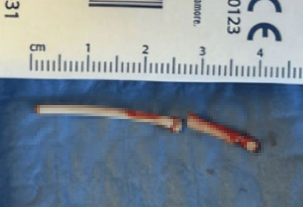 ���ŵ� ���� ��ġ