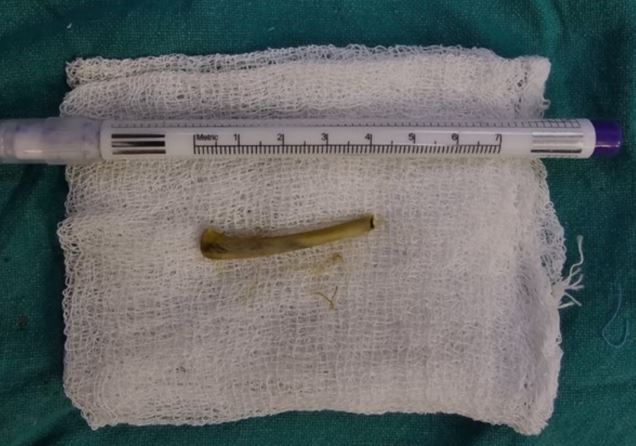 ���ŵ� �� ����