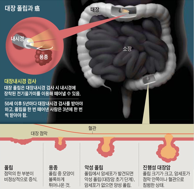 ����, ����, �� ���� �׷���