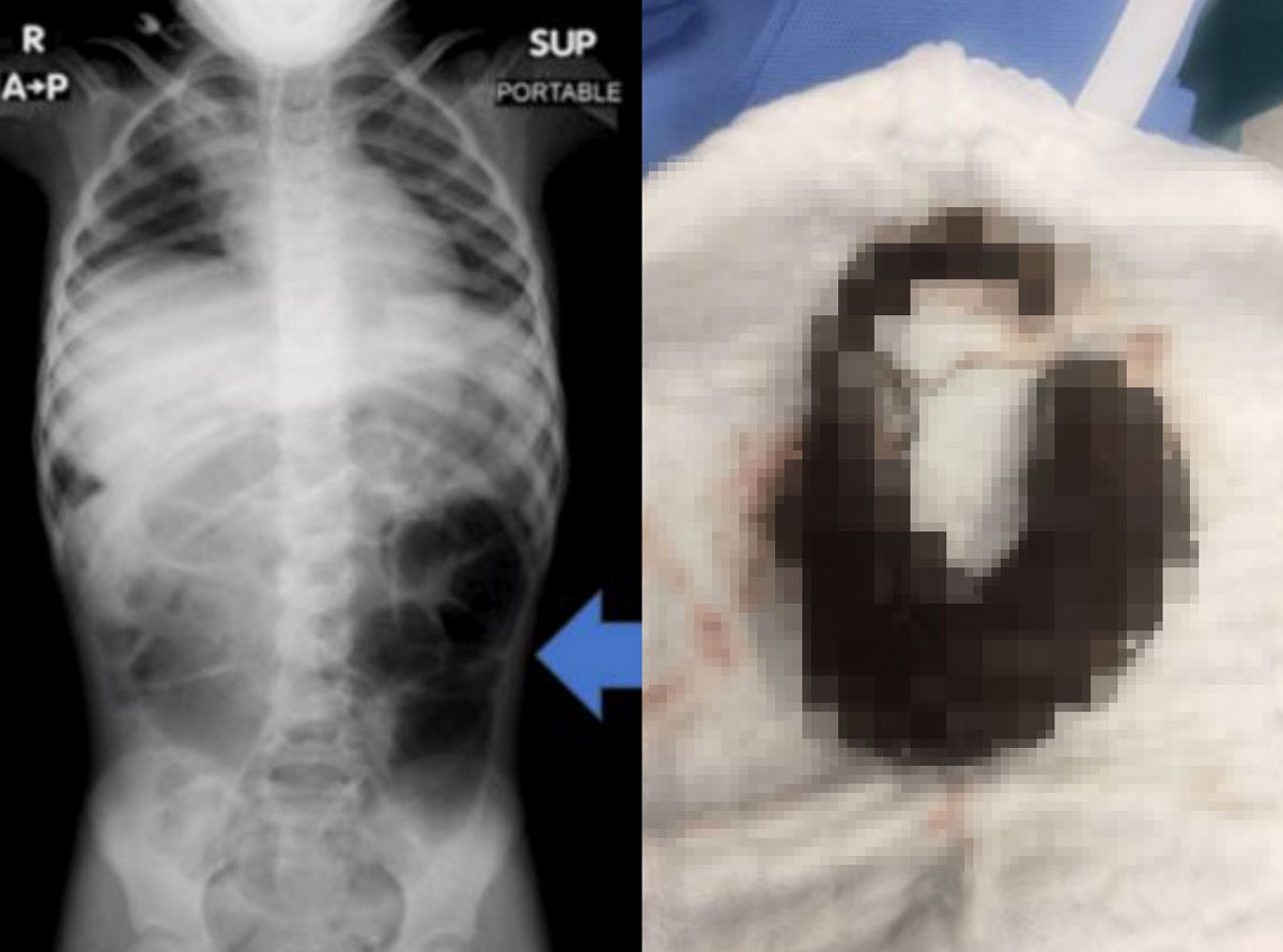 �������̿� ��� ����