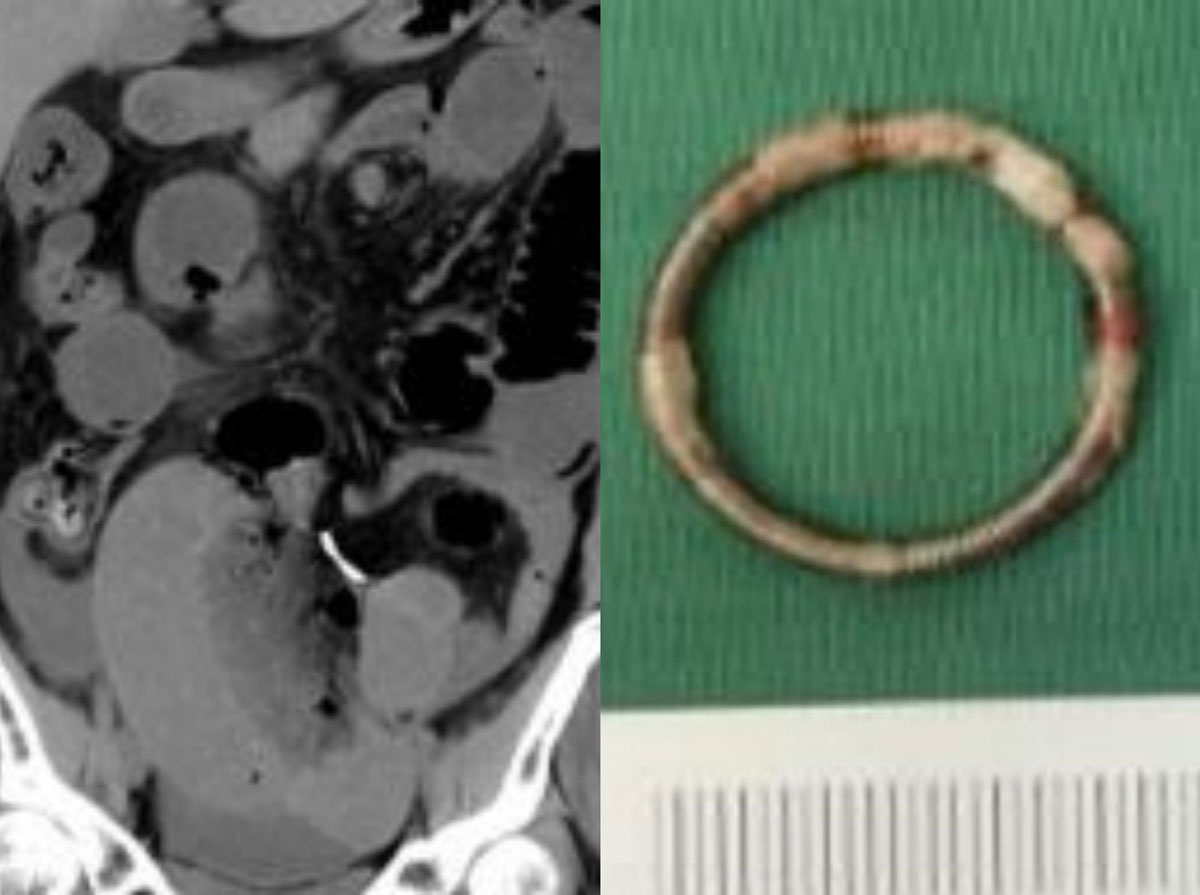 ct������ ���ӱⱸ ����