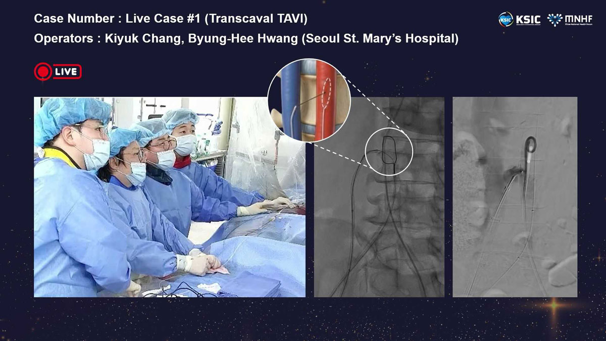 ���̺� �ü� ���