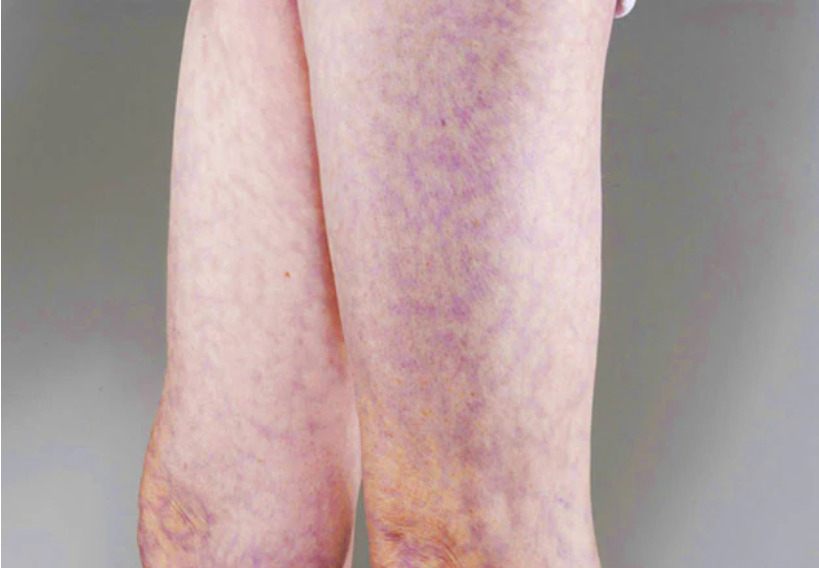 ���� ���