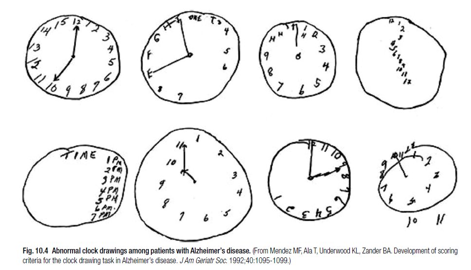 ġ�� ȯ�ڵ��� �׸� �ð� �׸�