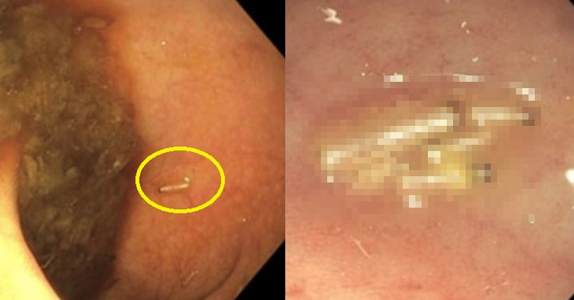 �� ���ð� ����