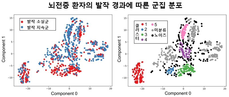 발작 유형 다양한 뇌전증… AI로 분석한 5가지 ‘장기 경과’