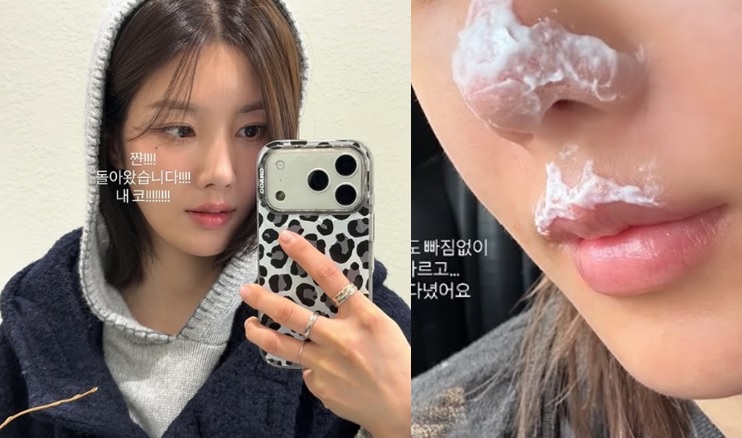 권은비, ‘이것’ 이후 코·입술에 화상 입었다… 무슨 일?