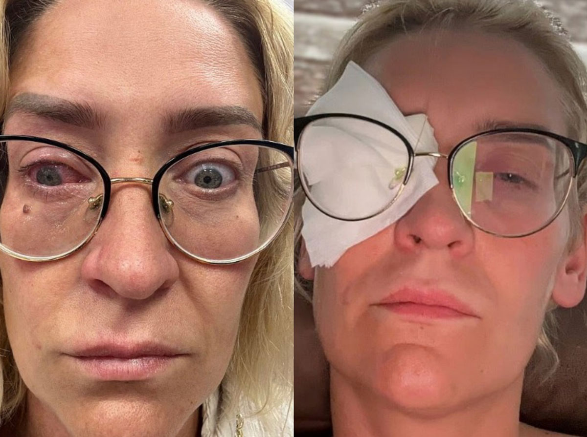 ‘이것’ 안 했다가 하룻밤 새 실명… 30대 女, 대체 무슨 일?