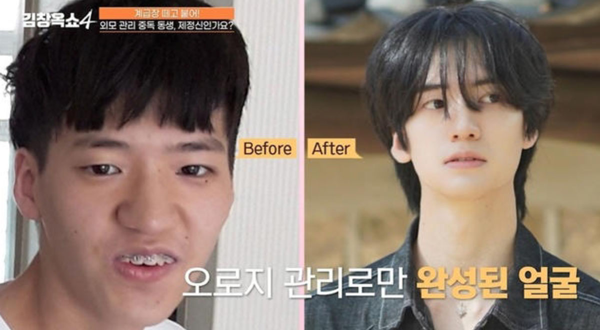 “성형 전혀 안 해”… 아이돌급 외모 변신 男, ‘이것’ 안 먹은 게 비결