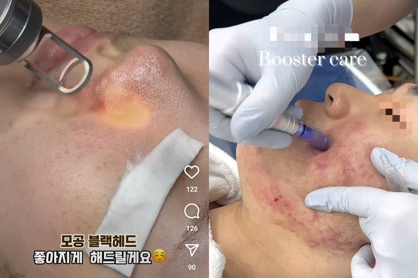 [단독] ‘주사 이모’만 문제? ‘레이저 이모’ 많은데… 경찰 신고해도 처벌 안 된다