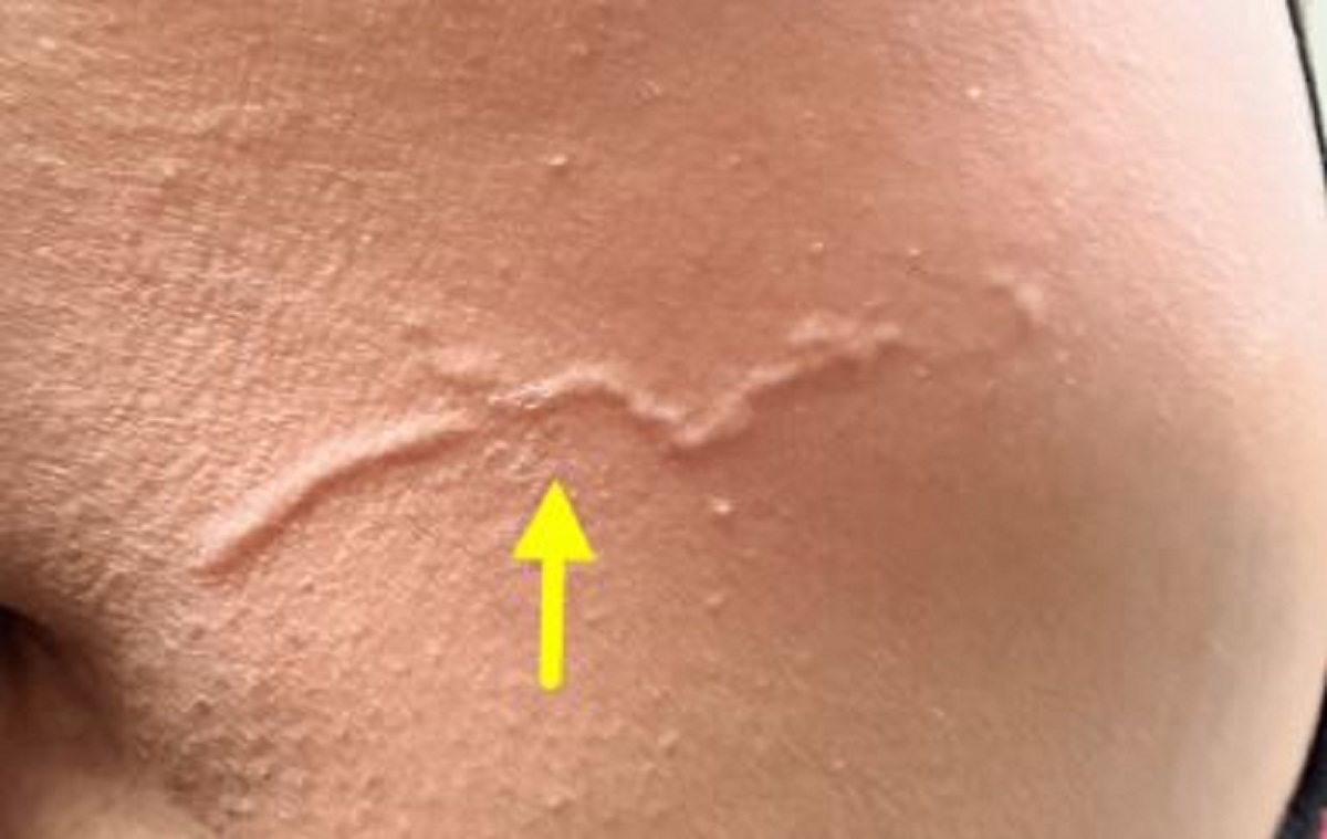 �� ��� �Ǻ� ����