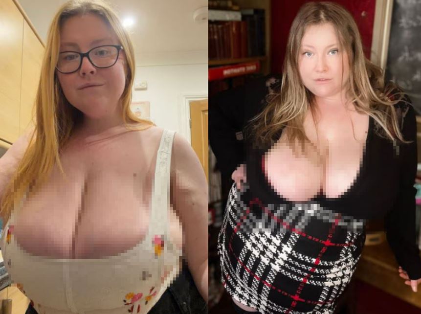 “살은 빠지는데, 가슴은 점점 커져”… 30대 女, 대체 무슨 일?