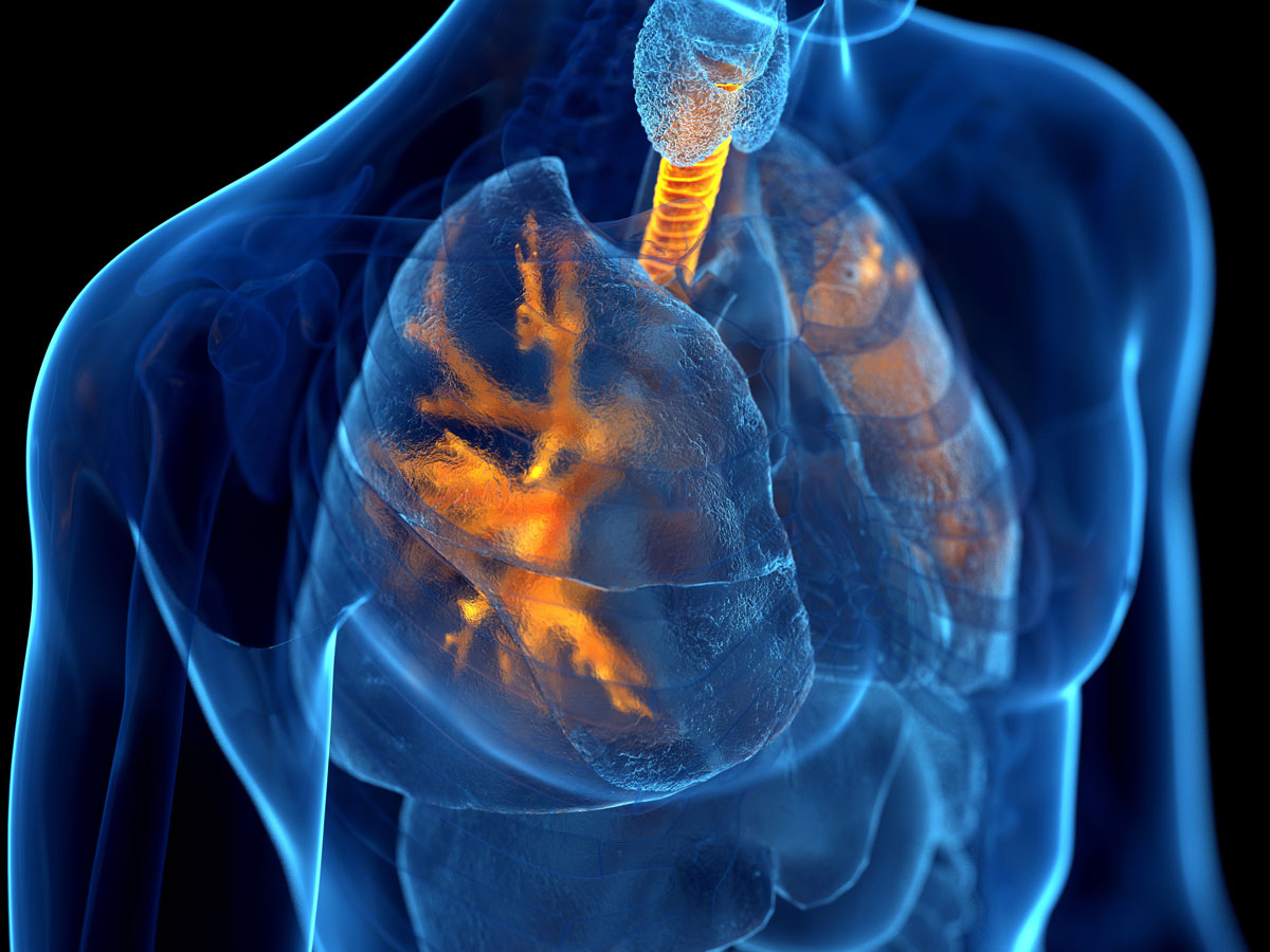 “담배 안 피우는데 왜?” 비흡연자도 ‘이 질환’ 있다면 폐암 위험 3배