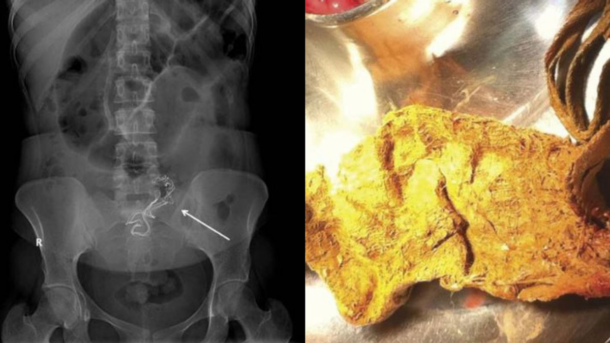 ������ ���� ����