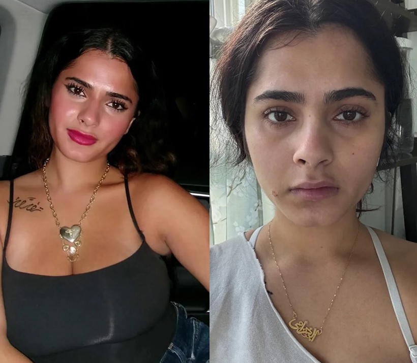 ‘이것’ 매일 마신 여대생, 머리카락 빠지고 치아 녹아… 뭐길래?