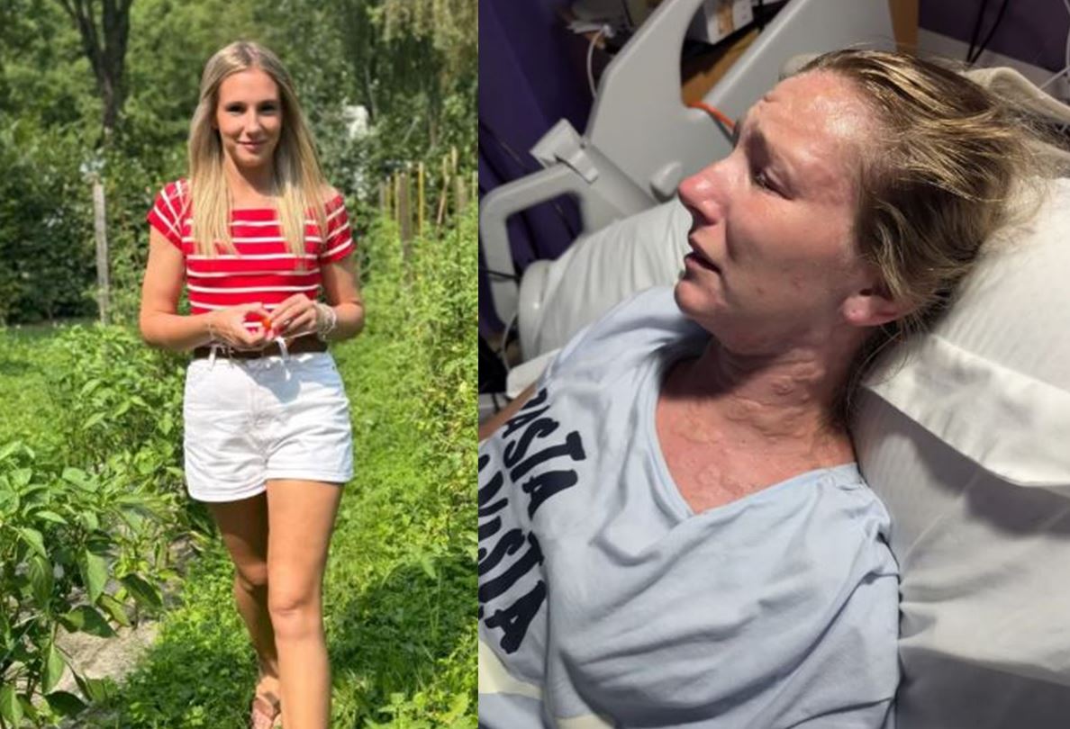 빨래 걷다가 넘어졌는데… 3주 뒤 반신마비된 英 여성, 무슨 일?