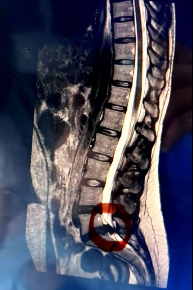 Ÿ�� ���亼�� ��������