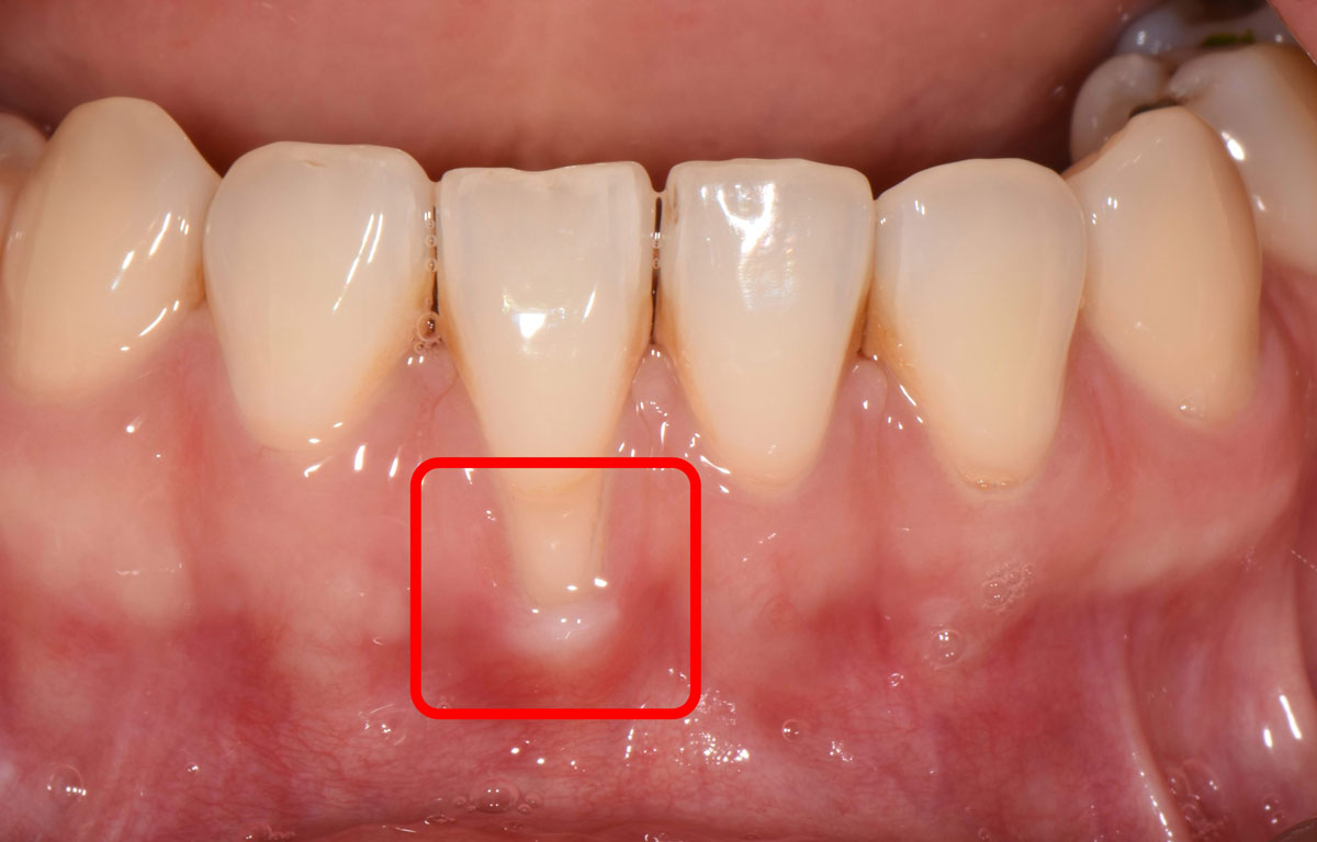 ġ�� ����