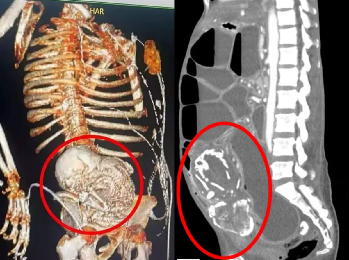 ��ȸȭ�� �¾� ����