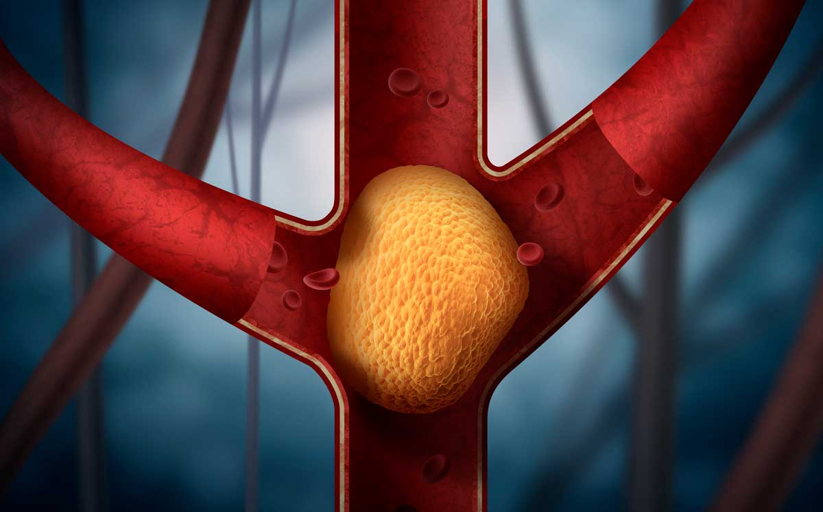 �ݷ����׷�