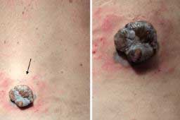 ������ ���� ����