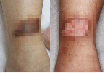 ȯ���� ���� ������ �� �� ����