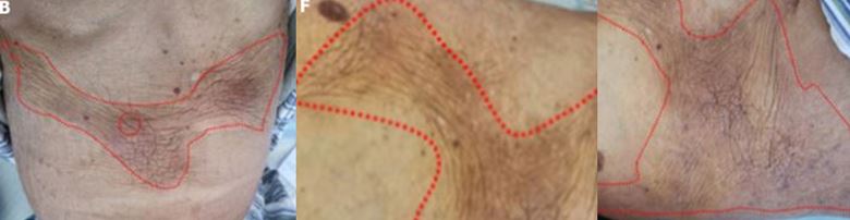 ���� ���� �Ǻ� ����