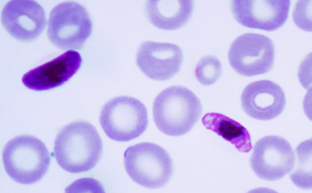 헌혈 혈액 말라리아 선별 검사 시약 ‘코바스 말라리아’, 국내 허가 획득