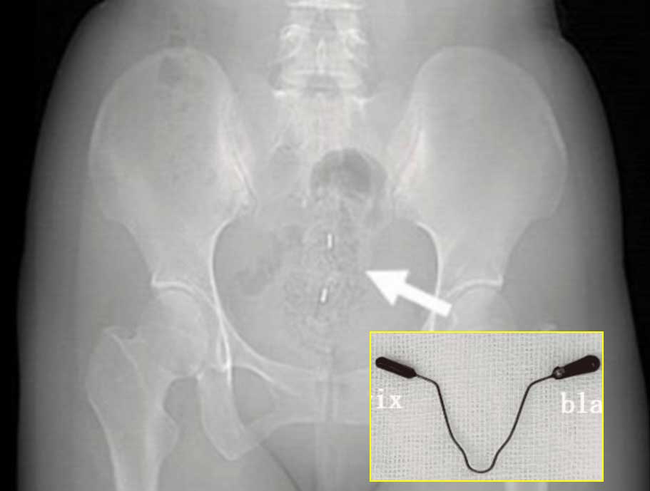 �������� ����