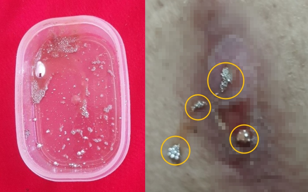 ���� �ߵ� ȯ�� ����