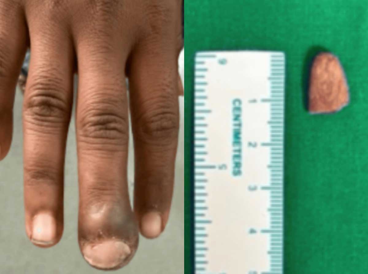 �հ����� ���ŵ� ���� ����