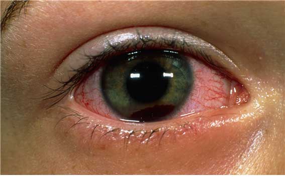 ������ ��