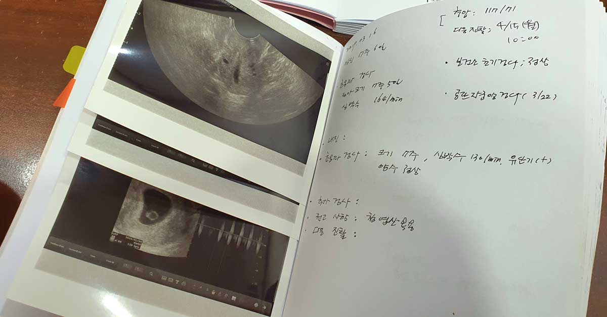 ����ø ����