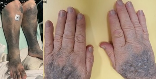 �̳����Ŭ�� ���߼� ������ħ�� ����� ����