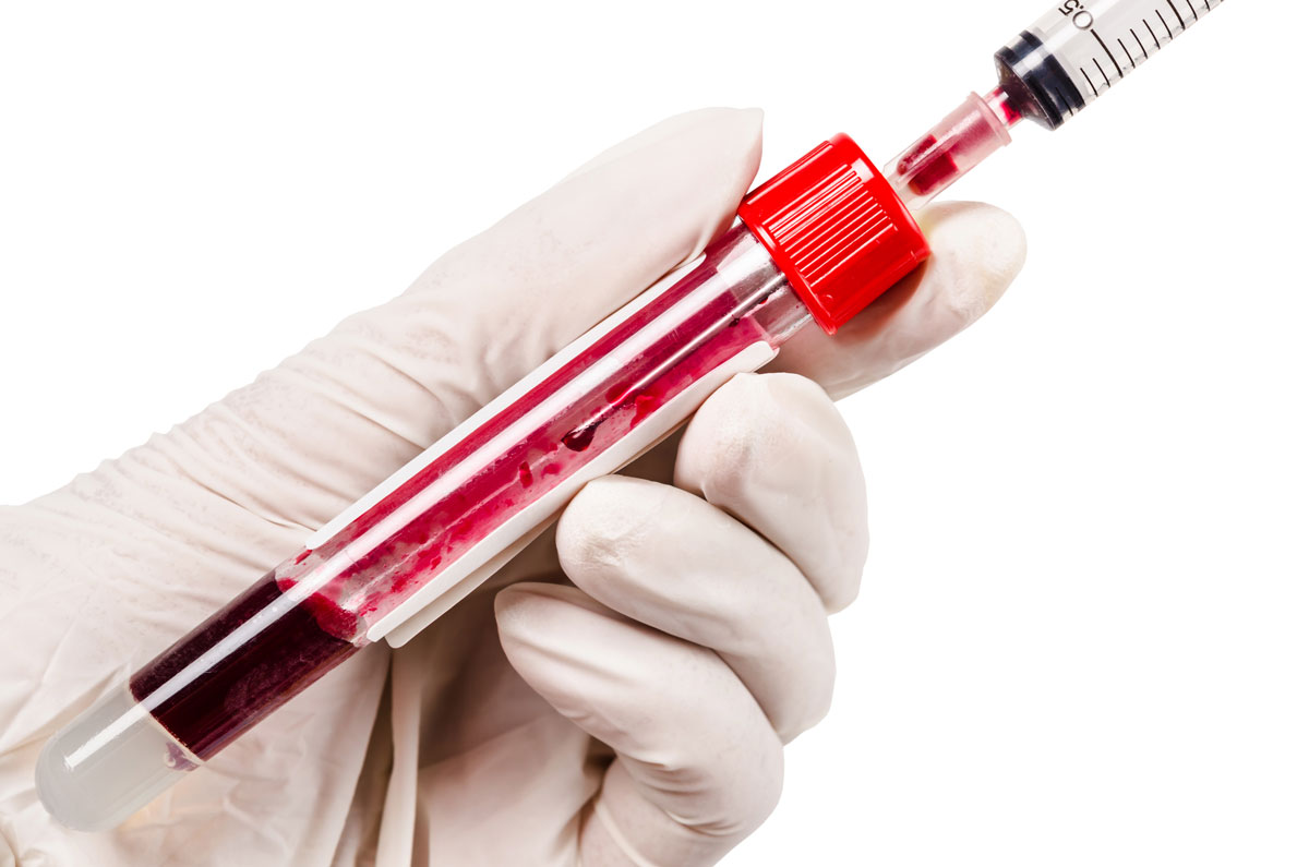 ���� �˻�