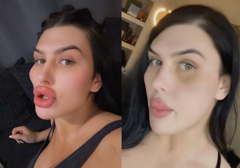 ���Ǿ� ����