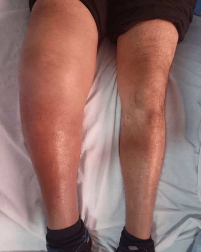 ȯ���� �ٸ�