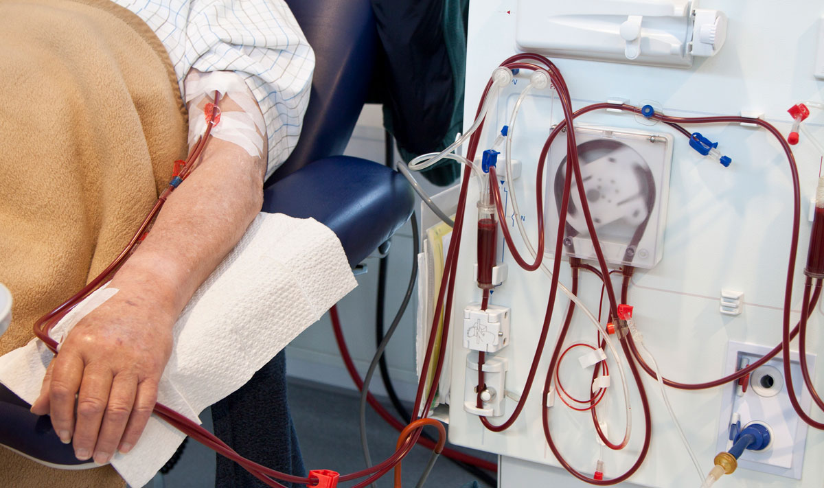 ���� ġ��