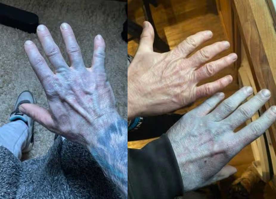 ��� ��ġ �̹���