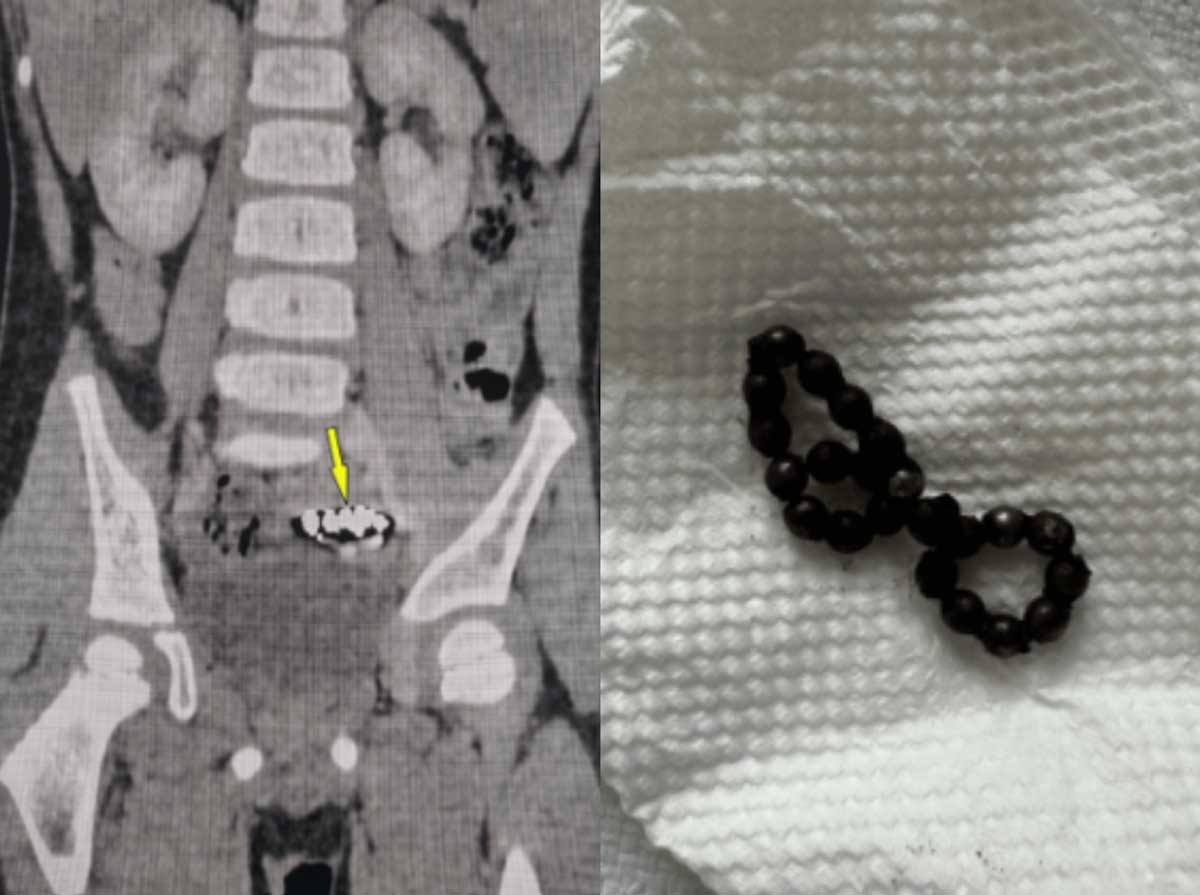 �������̿� �ڼ�