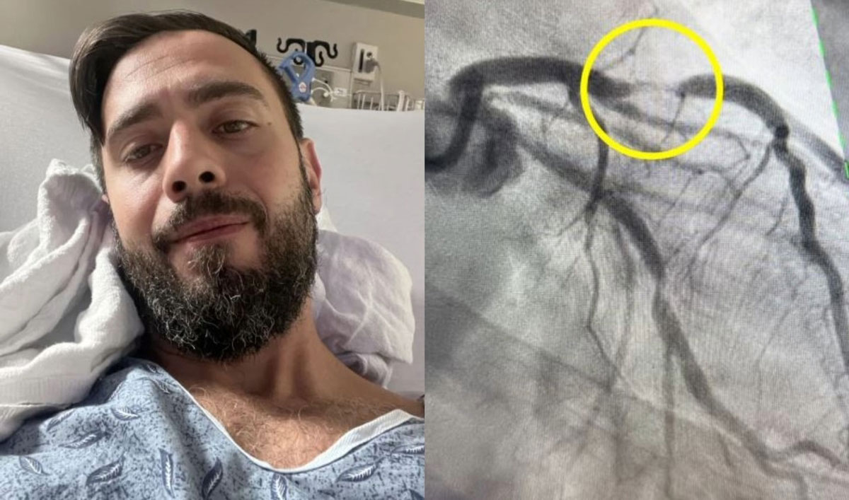 ������ ��ī����