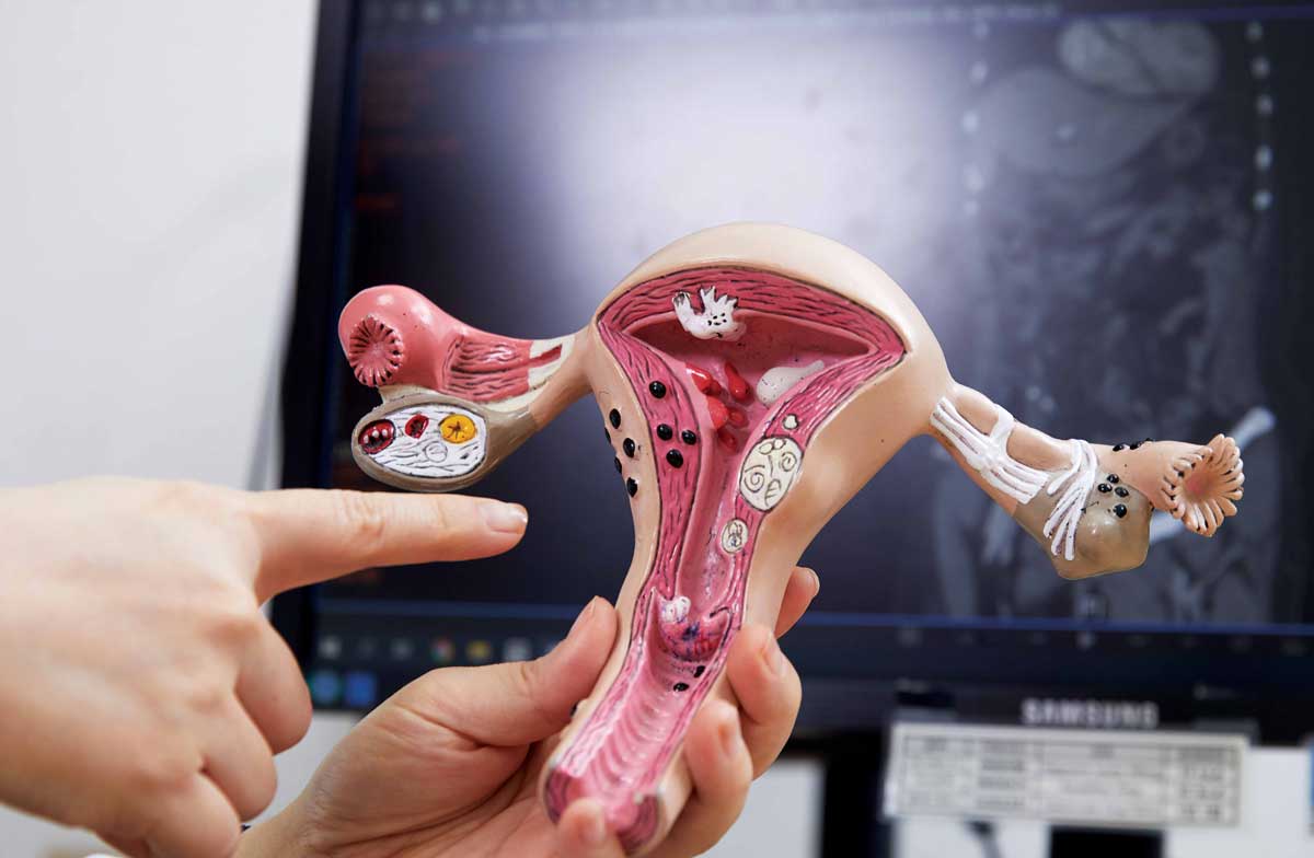 �ڱ� ����