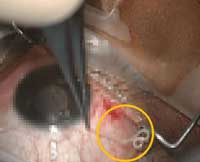 �� Ȯ��� ���